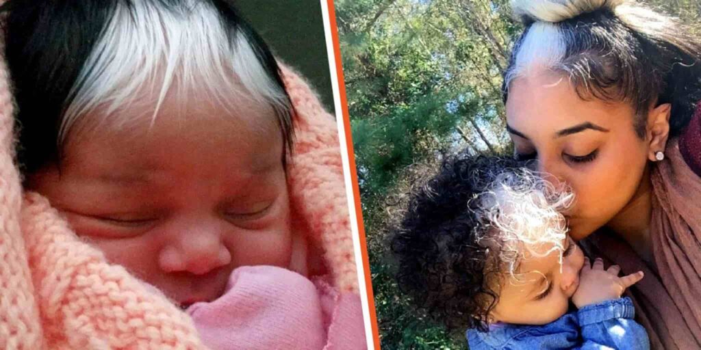  The baby’s special white hair was perfectly inherited from his mother