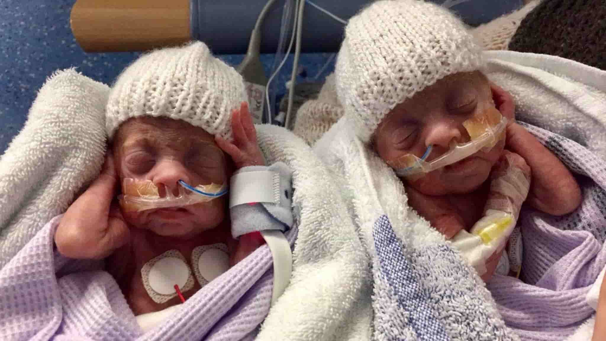 The Preemie twins returned after 150 days of treatment by a dedicated medical team, born at 24 weeks to the surprise and boundless happiness of their family.
