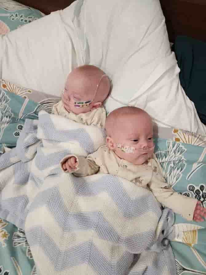 The Preemie twins returned after 150 days of treatment by a dedicated medical team, born at 24 weeks to the surprise and boundless happiness of their family.